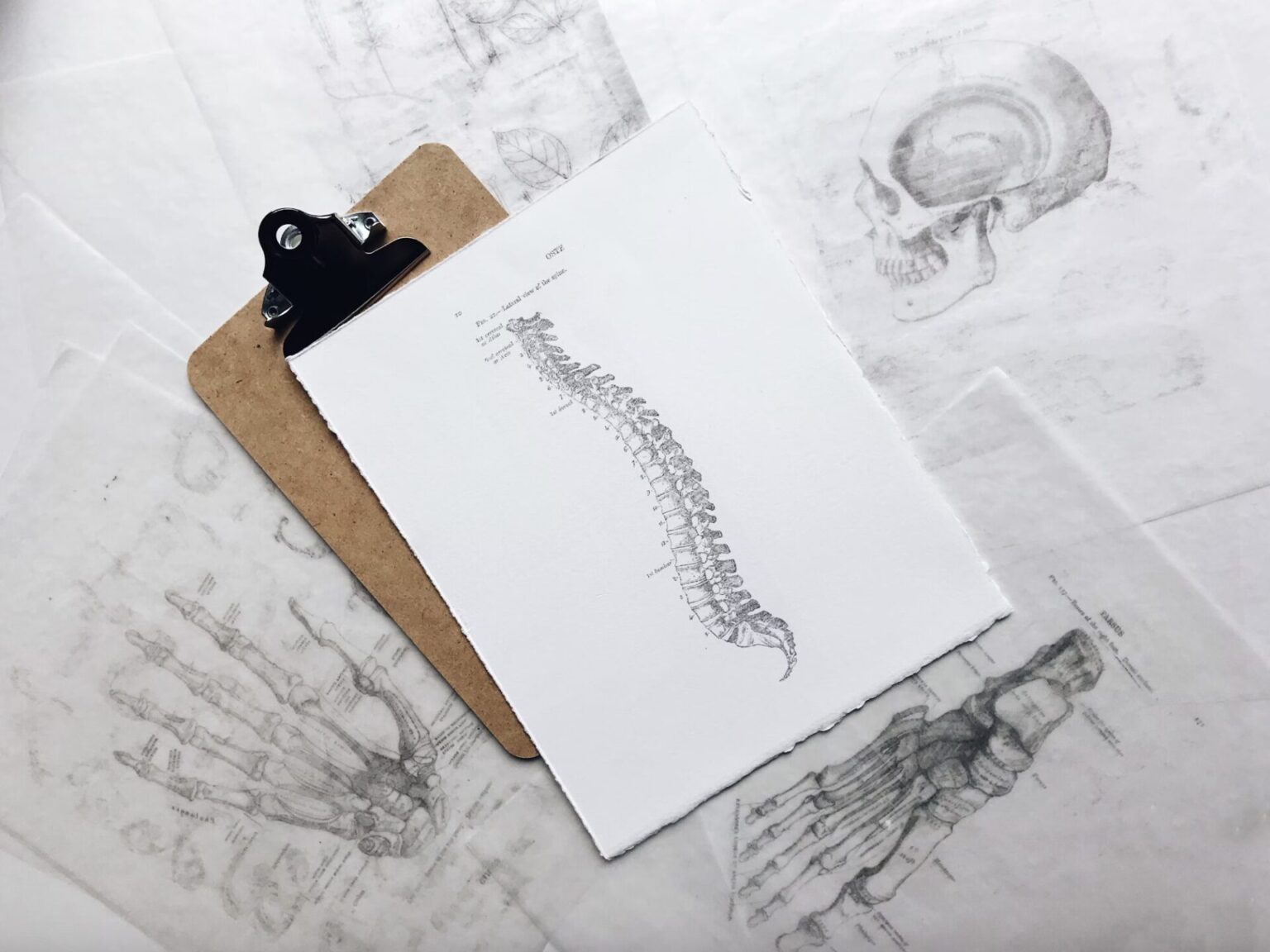 Diagram of spine, depicting rheumatoid arthritis which can be aided by infrared sauna sessions